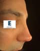 Slider image (6) Dr. Emin Eren Clinic